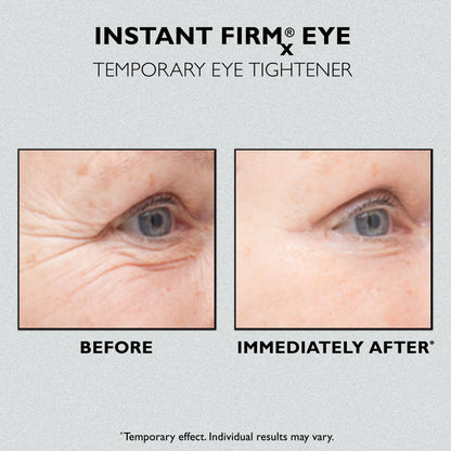 Peter Thomas Roth | Instant FIRMx Temporary Eye Tightener | Firm and Smooth the Look of Fine Lines